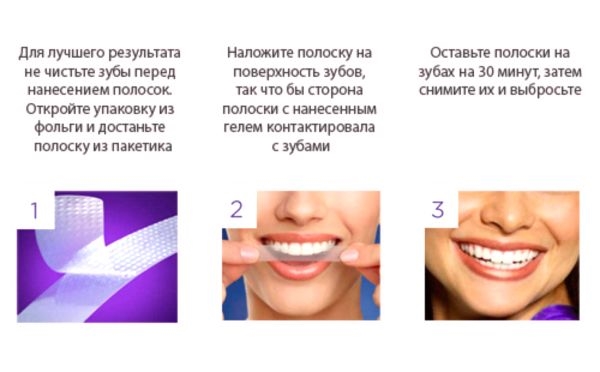 Какие отбеливающие полоски для зубов лучше? Принцип действия и отзывы