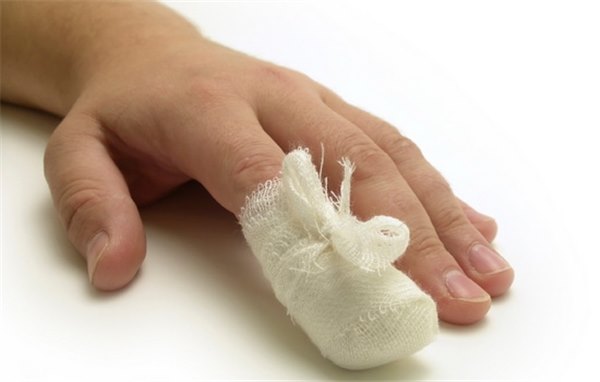 Ушиб ногтя на руке или не ноге: что делать в первые минуты, как спасти ноготь