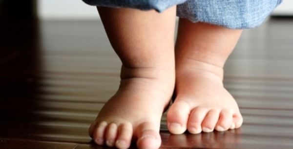 Плоско-вальгусная деформация стоп ребенка: причины, лечение, профилактика