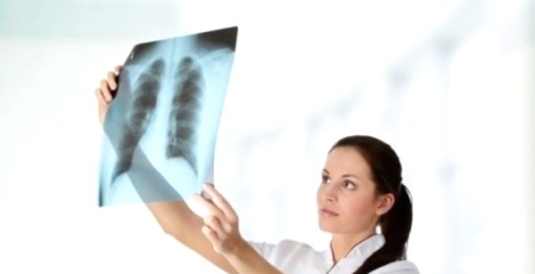 Туберкулез: симптомы и лечение заболевания