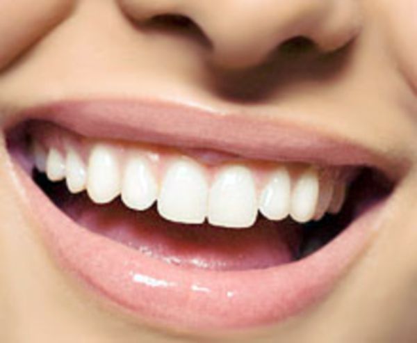Лечение зубов современными методами без боли. Как появляется кариес: причины возникновения кариеса. Современные пломбы