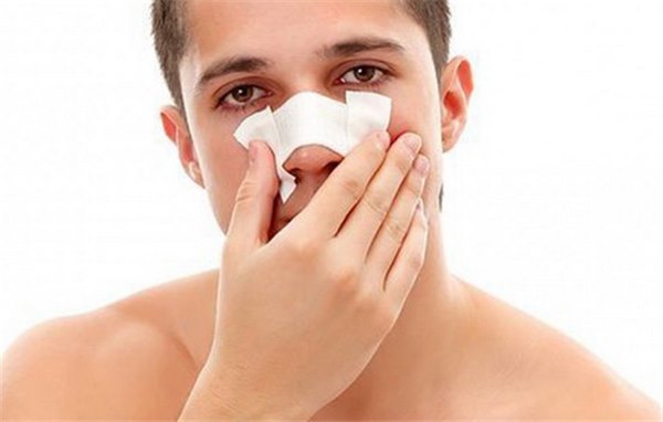 Как распознать ушиб носа и признаки осложнений травмы