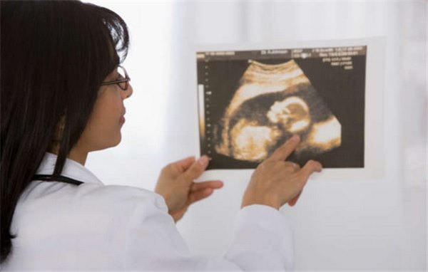 Маловодие при беременности – сказывается ли на родах
