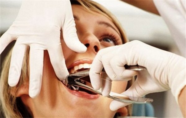 Воспаление после удаления зуба, причины и симптомы
