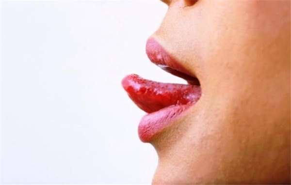 Воспаление языка - причины, симптомы и лечение